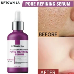 Anti-Acne Face Serum