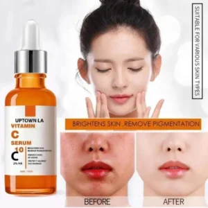 Dark Spots Removal Vitamin-C Serum